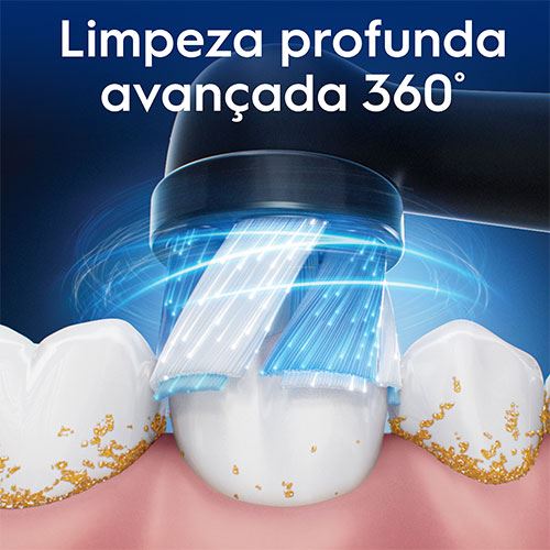 1520