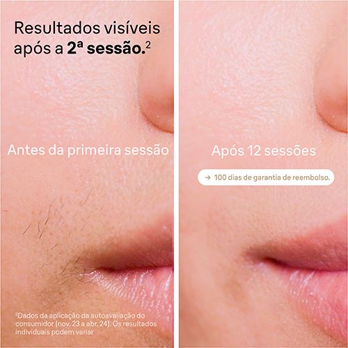 1520